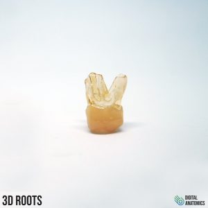 3d roots tooth with open appex