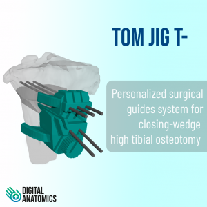 TOM JIG T- . Sistema de guías quirúrgicas personalizadas para osteotomía de tibial de sustracción