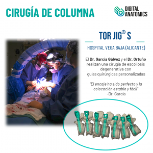 Primera cirugía en el Hospital de La Vega Baja con las guías quirúrgicas personalizadas TOR JIG