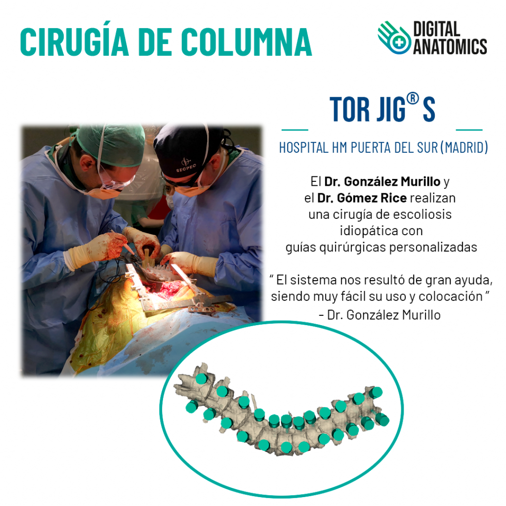 Cirugía en el Hospital HM Universitario Puerta del Sur usando las guías quirúrgicas personalizadas TOR JIG
