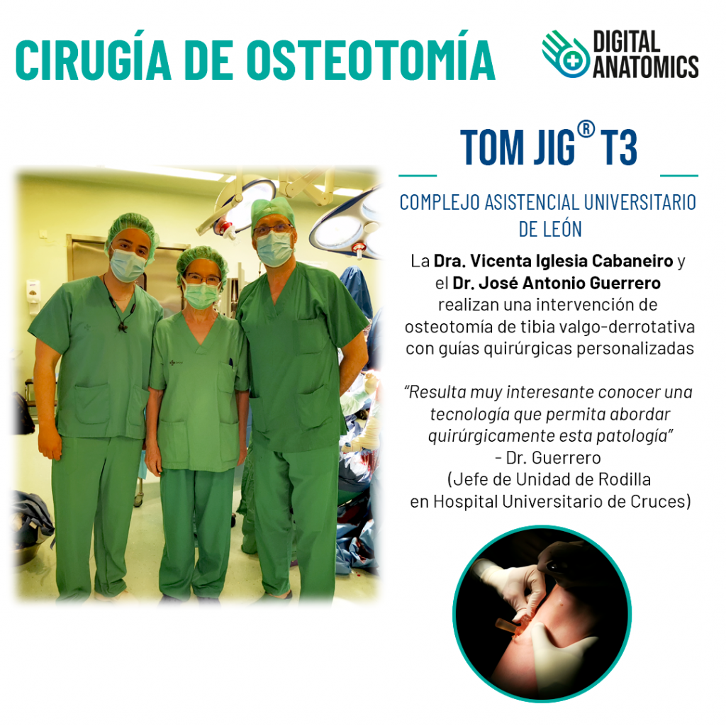 Cirugía de osteotomía de tibia valgo-derrotativa con guías quirúrgicas personalizadas